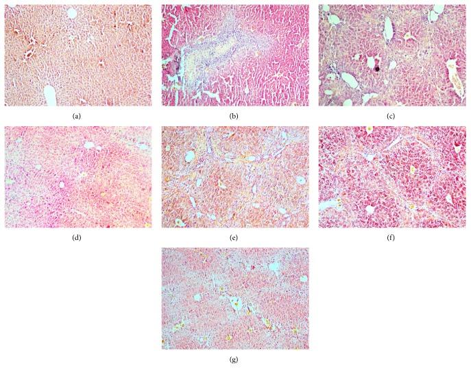 https://cdn.ncbi.nlm.nih.gov/pmc/blobs/9b77/4879235/76c0b5a74e0f/ECAM2016-2974256.001.jpg