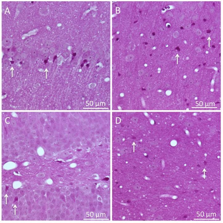 https://cdn.ncbi.nlm.nih.gov/pmc/blobs/9b78/5772856/e8d2290e65c1/ad-9-1-31-g5.jpg