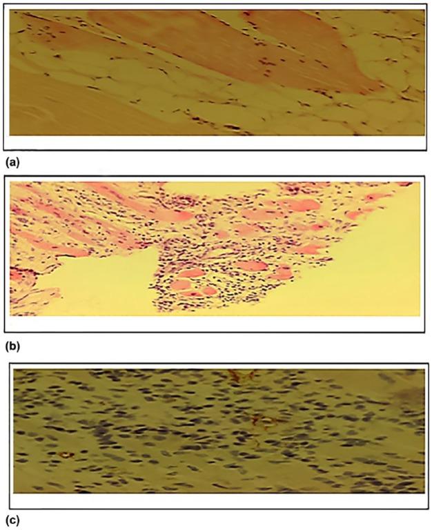 https://cdn.ncbi.nlm.nih.gov/pmc/blobs/9b7a/5933591/1837b5b449e4/10.1177_1753944717745494-fig9.jpg