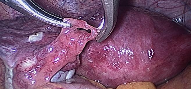https://cdn.ncbi.nlm.nih.gov/pmc/blobs/9b81/11198887/180570045885/FVVinObGyn-16-67-g001.jpg