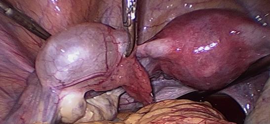 https://cdn.ncbi.nlm.nih.gov/pmc/blobs/9b81/11198887/55fffc0d6658/FVVinObGyn-16-67-g006.jpg