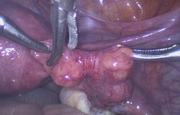 https://cdn.ncbi.nlm.nih.gov/pmc/blobs/9b81/11198887/99812457415c/FVVinObGyn-16-67-g003.jpg