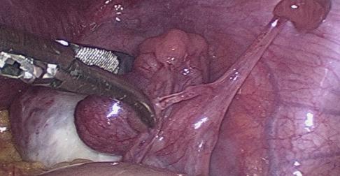 https://cdn.ncbi.nlm.nih.gov/pmc/blobs/9b81/11198887/bb2877216779/FVVinObGyn-16-67-g005.jpg
