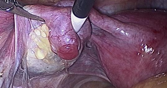https://cdn.ncbi.nlm.nih.gov/pmc/blobs/9b81/11198887/ec2de004d78e/FVVinObGyn-16-67-g004.jpg