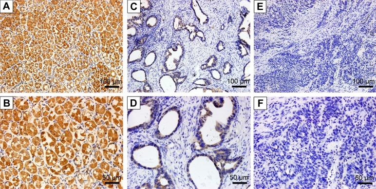 https://cdn.ncbi.nlm.nih.gov/pmc/blobs/9b84/5065259/3af1eff2cd9c/ott-9-6099Fig2.jpg