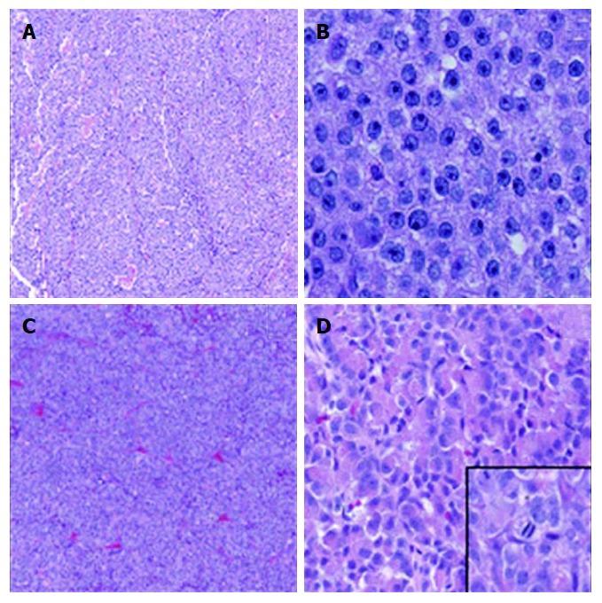 https://cdn.ncbi.nlm.nih.gov/pmc/blobs/9b8e/5725289/dd9ffe5b426d/WJG-23-7945-g001.jpg