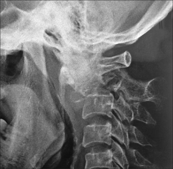 https://cdn.ncbi.nlm.nih.gov/pmc/blobs/9b96/5379789/7b453063b480/AJNS-12-134-g001.jpg