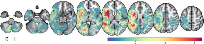 https://cdn.ncbi.nlm.nih.gov/pmc/blobs/9b96/7578057/4a8bb6fbdb45/41598_2020_75074_Fig1_HTML.jpg