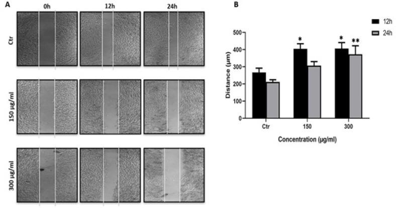 https://cdn.ncbi.nlm.nih.gov/pmc/blobs/9b98/7798177/7b58ff9da486/APJCP-21-2993-g006.jpg