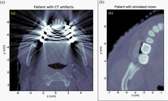 https://cdn.ncbi.nlm.nih.gov/pmc/blobs/9b9a/5720502/fdb508c11a24/ACM2-10-080-g003.jpg