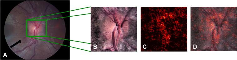 https://cdn.ncbi.nlm.nih.gov/pmc/blobs/9b9b/11046195/261623d975ad/gr3.jpg