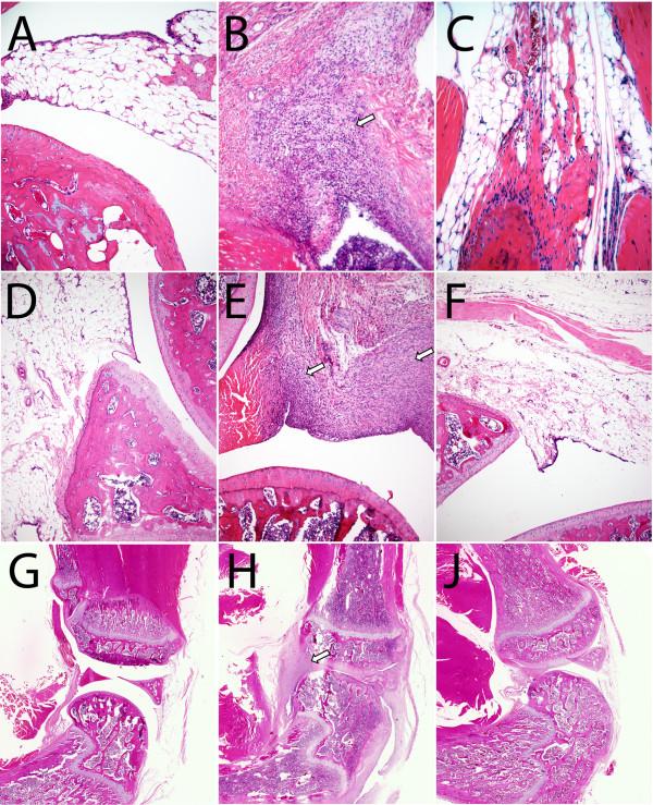 https://cdn.ncbi.nlm.nih.gov/pmc/blobs/9b9c/3506445/0146199e3f93/1476-9255-9-24-7.jpg