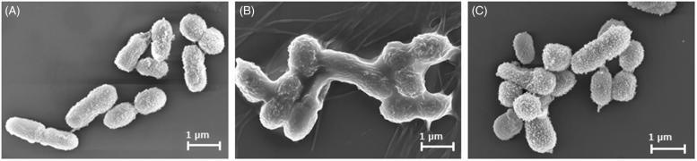 https://cdn.ncbi.nlm.nih.gov/pmc/blobs/9ba2/6691759/ee2250641b22/TMYB_A_1575585_F0003_B.jpg