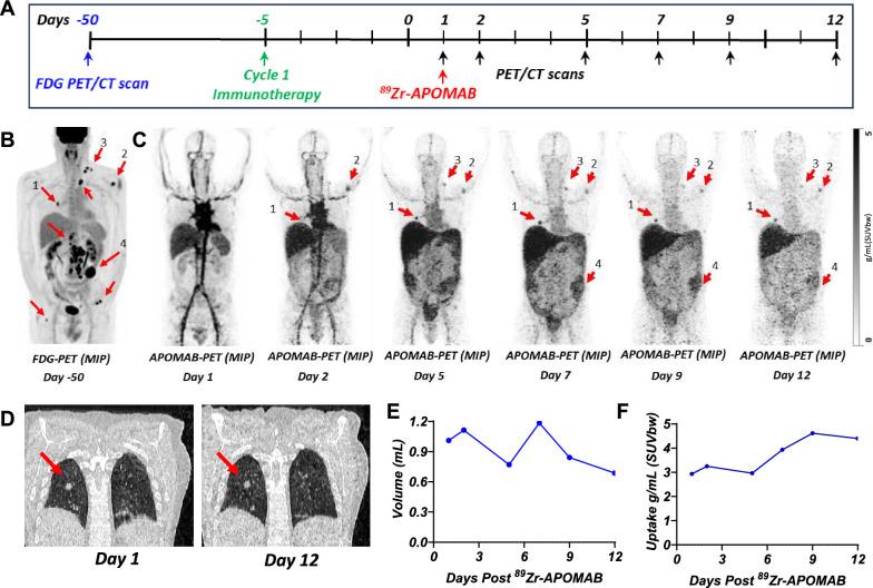 https://cdn.ncbi.nlm.nih.gov/pmc/blobs/9ba3/12164067/9f2c610ce090/12967_2025_6684_Fig6_HTML.jpg