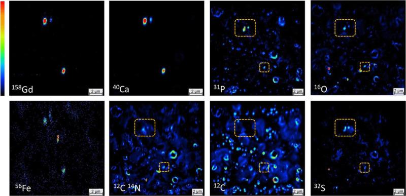 https://cdn.ncbi.nlm.nih.gov/pmc/blobs/9ba3/9855751/9833bbab8bd1/ir-57-283-g006.jpg