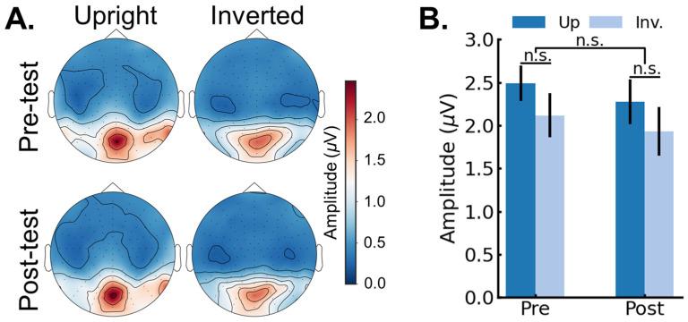 https://cdn.ncbi.nlm.nih.gov/pmc/blobs/9ba6/10886861/337a7a55cd64/brainsci-14-00146-g005.jpg