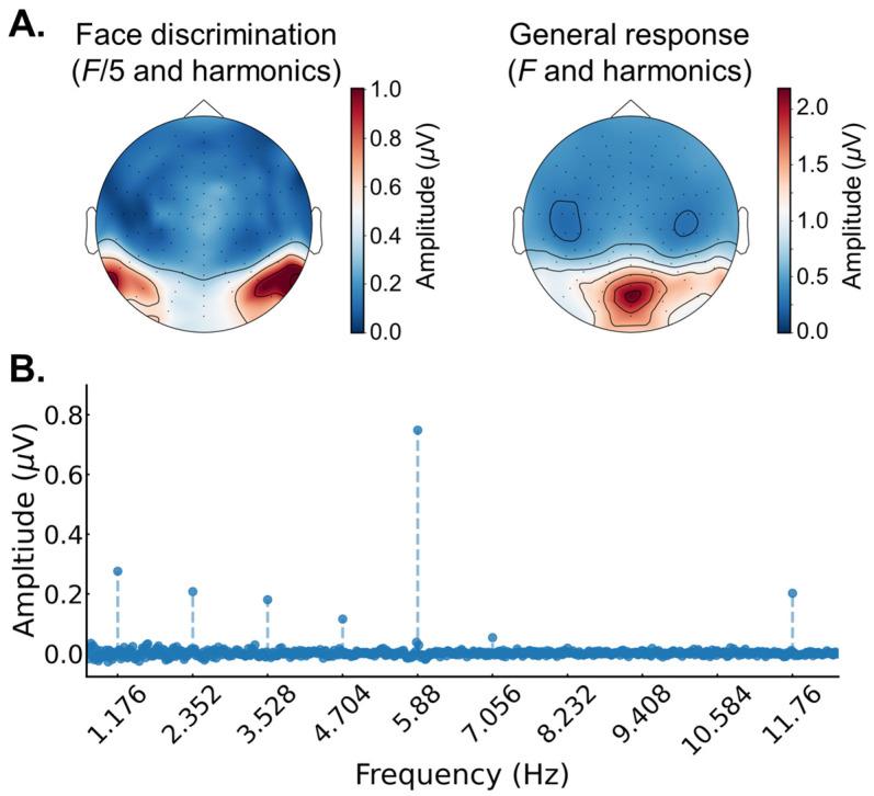 https://cdn.ncbi.nlm.nih.gov/pmc/blobs/9ba6/10886861/d20677e75919/brainsci-14-00146-g003.jpg
