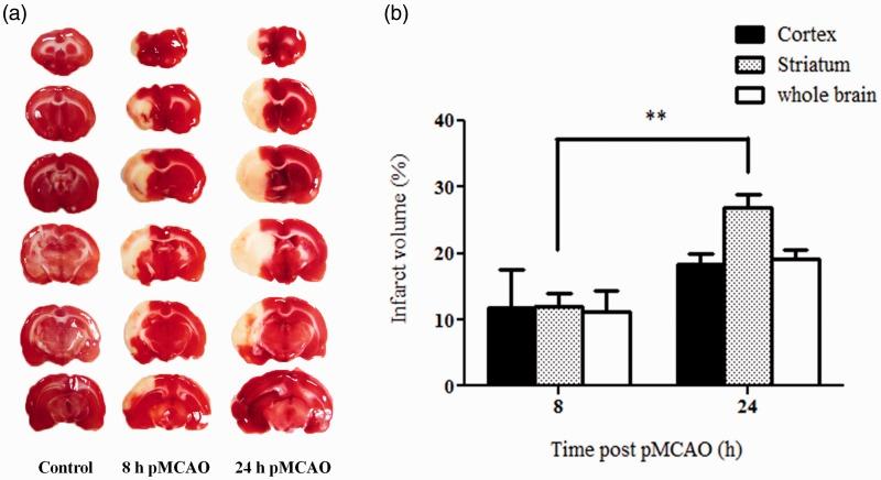 https://cdn.ncbi.nlm.nih.gov/pmc/blobs/9ba9/4397212/7f96f2eb19eb/10.1177_1759091415578711-fig7.jpg