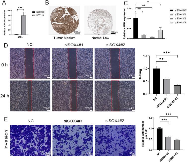 https://cdn.ncbi.nlm.nih.gov/pmc/blobs/9bab/11032667/3c26a68c0c14/OTT-17-345-g0007.jpg