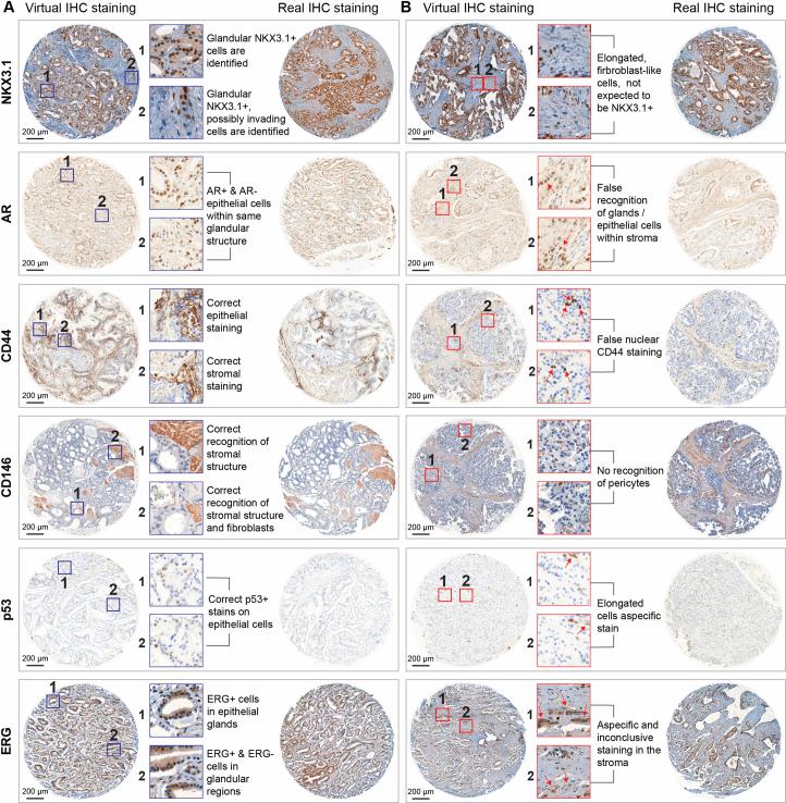 https://cdn.ncbi.nlm.nih.gov/pmc/blobs/9bab/11415301/04d42b40ee4c/42256_2024_889_Fig8_ESM.jpg