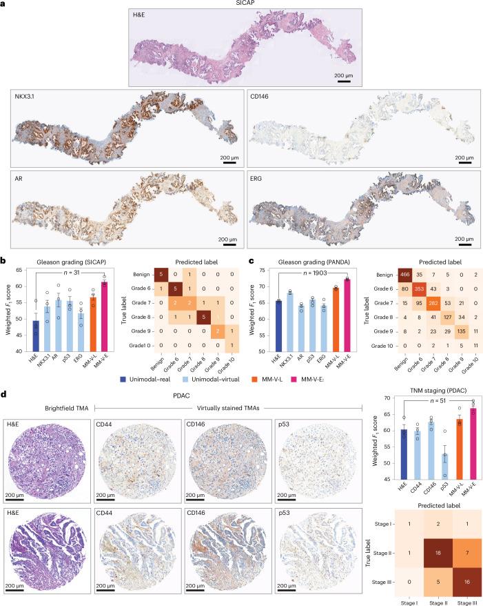 https://cdn.ncbi.nlm.nih.gov/pmc/blobs/9bab/11415301/72d991672200/42256_2024_889_Fig6_HTML.jpg