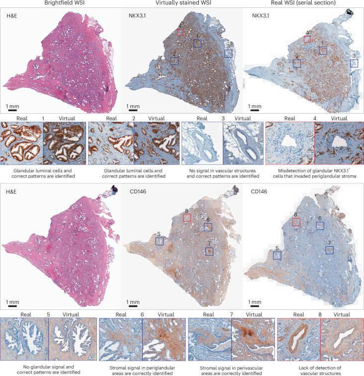 https://cdn.ncbi.nlm.nih.gov/pmc/blobs/9bab/11415301/8e55c1b557e4/42256_2024_889_Fig4_HTML.jpg