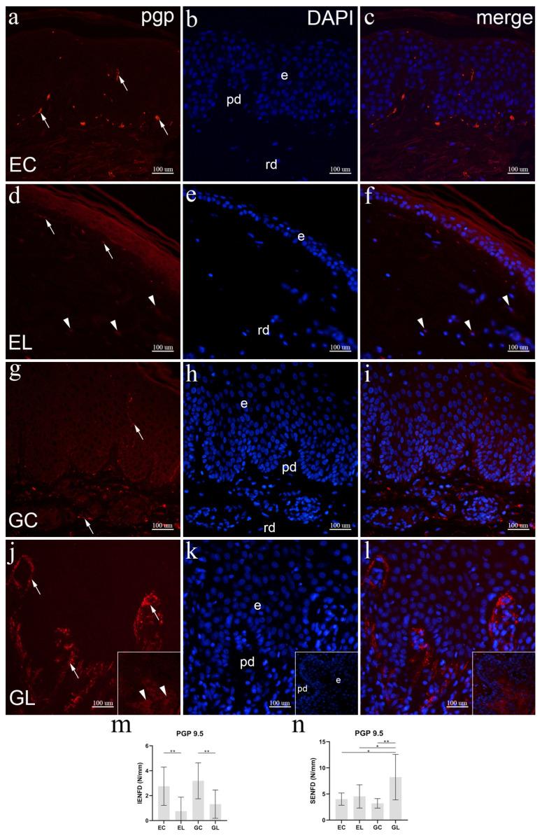 https://cdn.ncbi.nlm.nih.gov/pmc/blobs/9bb1/9775107/9169a7fc524a/biomolecules-12-01767-g006.jpg