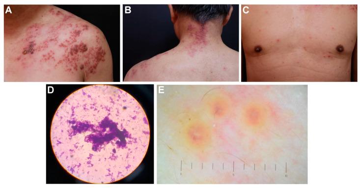 https://cdn.ncbi.nlm.nih.gov/pmc/blobs/9bb2/10532883/a534ab25644a/medicina-59-01542-g001.jpg