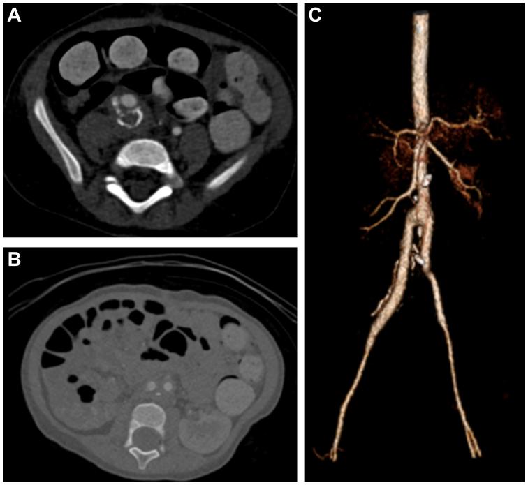 https://cdn.ncbi.nlm.nih.gov/pmc/blobs/9bb9/11167345/8fa4e83caa8d/gr4.jpg