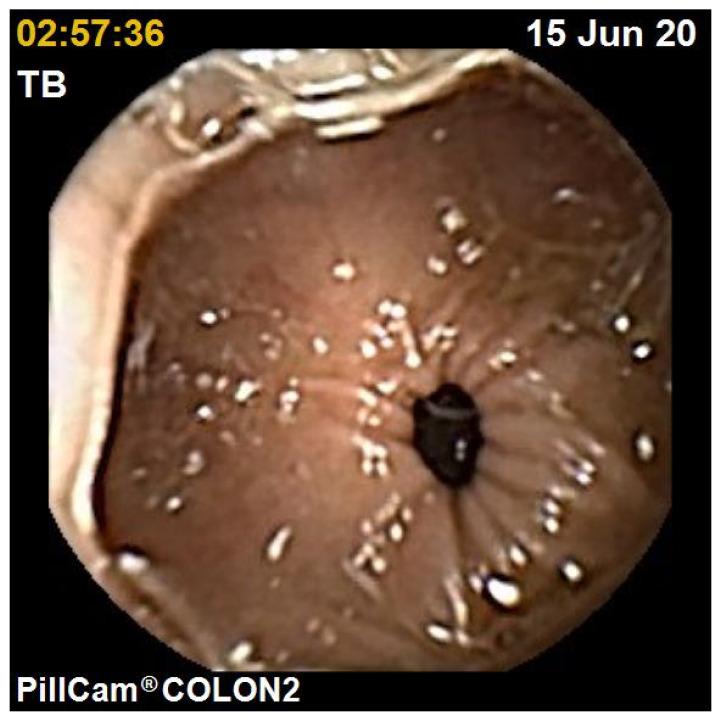 https://cdn.ncbi.nlm.nih.gov/pmc/blobs/9bb9/8199426/346eba53c9a8/jcm-10-02372-g001.jpg