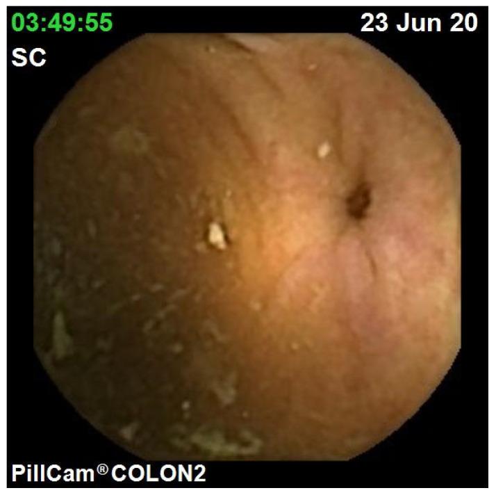 https://cdn.ncbi.nlm.nih.gov/pmc/blobs/9bb9/8199426/a4798dac6f5e/jcm-10-02372-g004.jpg