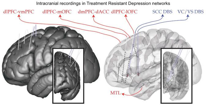 https://cdn.ncbi.nlm.nih.gov/pmc/blobs/9bbb/8092047/4f95d062741a/fnhum-15-644593-g001.jpg