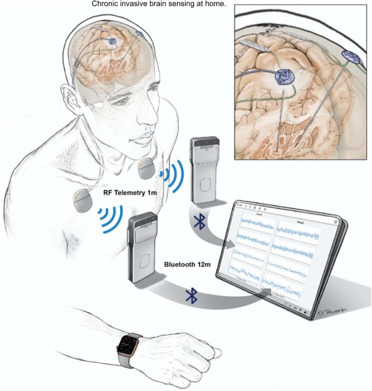 https://cdn.ncbi.nlm.nih.gov/pmc/blobs/9bbb/8092047/b4d8d70ba5ab/fnhum-15-644593-g006.jpg