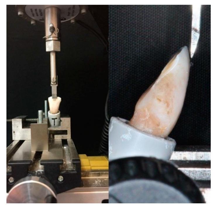 https://cdn.ncbi.nlm.nih.gov/pmc/blobs/9bc5/7999612/8621a490920b/materials-14-01341-g001.jpg