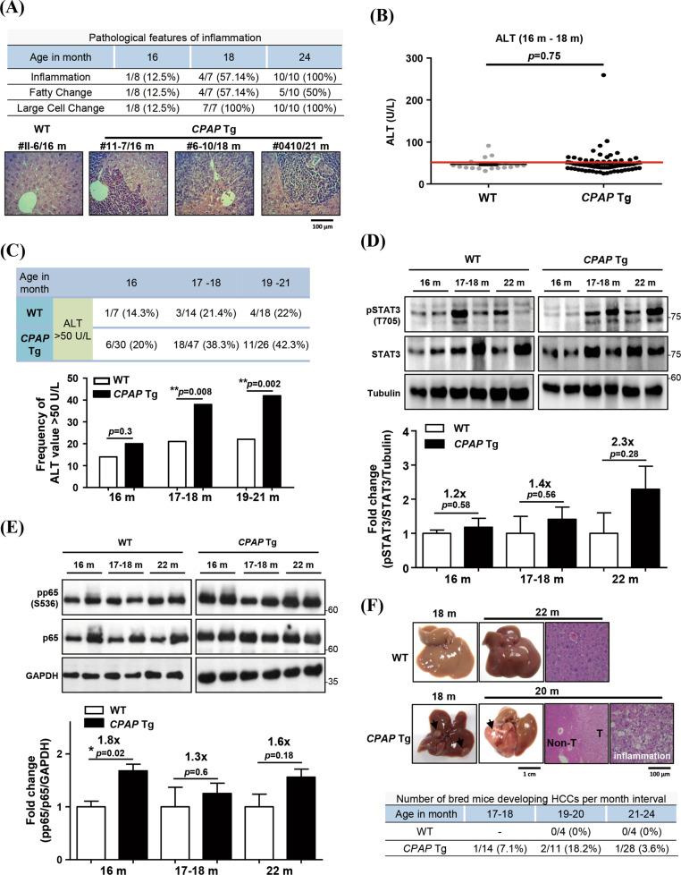 https://cdn.ncbi.nlm.nih.gov/pmc/blobs/9bc5/8536685/c4909a094973/41419_2021_4295_Fig1_HTML.jpg