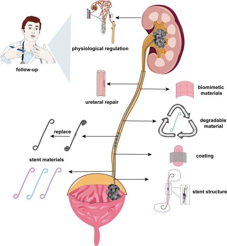 https://cdn.ncbi.nlm.nih.gov/pmc/blobs/9bcb/10710215/eb4bc138696d/j_med-2023-0854-fig001.jpg