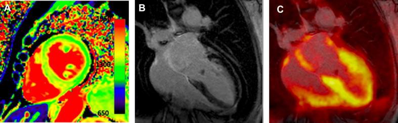 https://cdn.ncbi.nlm.nih.gov/pmc/blobs/9bcb/7191222/aa74b5627305/gr3.jpg