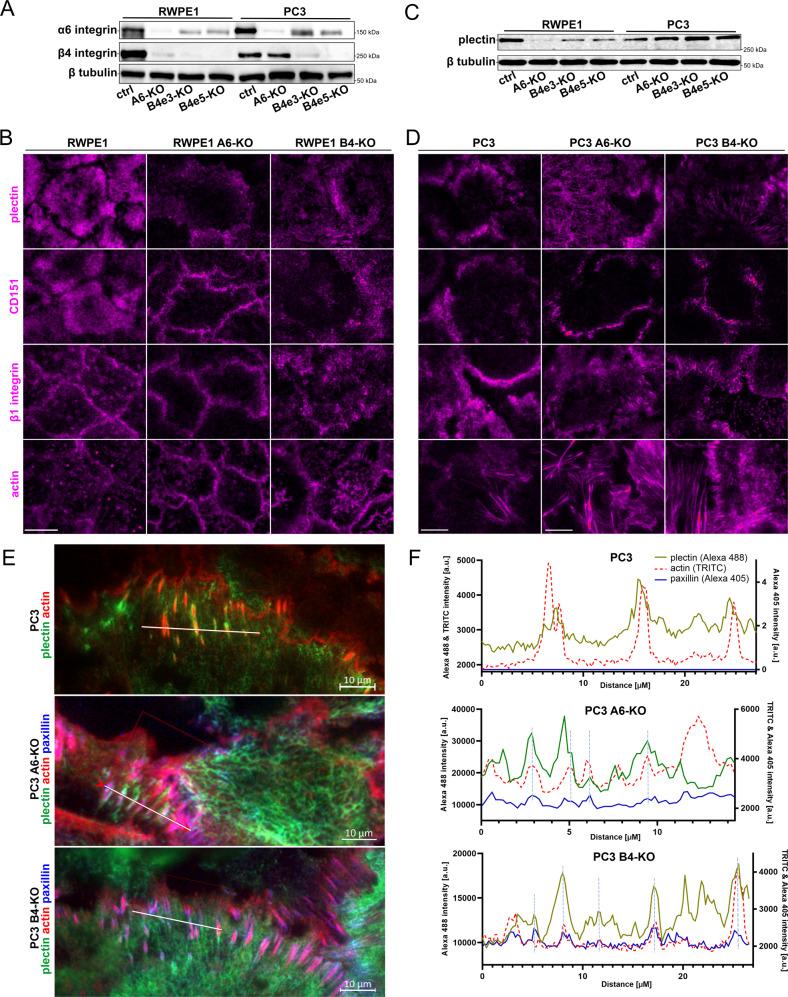 https://cdn.ncbi.nlm.nih.gov/pmc/blobs/9bd1/9307480/d11ee0379528/41388_2022_2389_Fig2_HTML.jpg