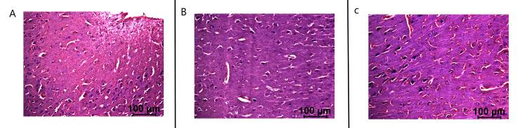 https://cdn.ncbi.nlm.nih.gov/pmc/blobs/9bd3/10506916/587de200e195/cureus-0015-00000043774-i12.jpg