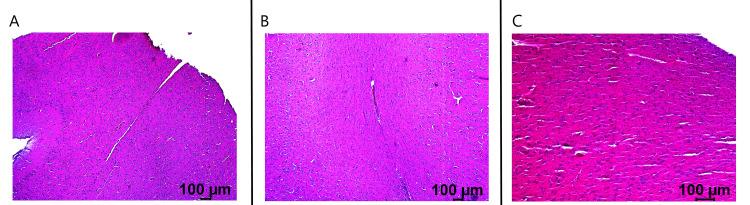 https://cdn.ncbi.nlm.nih.gov/pmc/blobs/9bd3/10506916/c58a99e44c01/cureus-0015-00000043774-i11.jpg