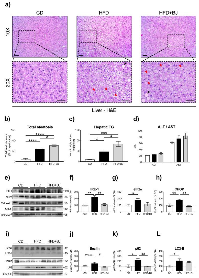 https://cdn.ncbi.nlm.nih.gov/pmc/blobs/9bd7/10892331/4e10ab1417ce/nutrients-16-00513-g004.jpg