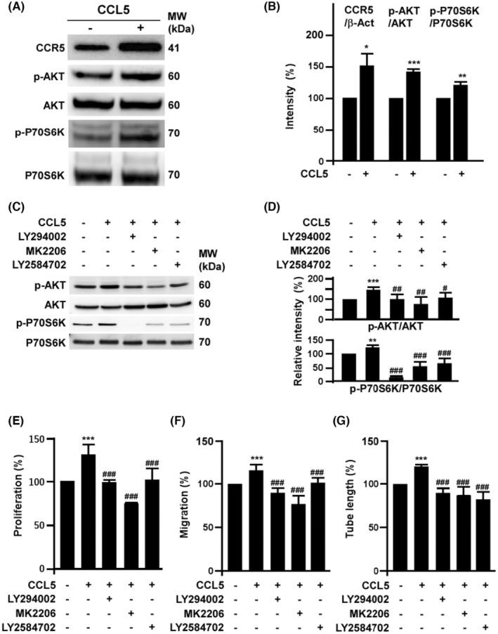 https://cdn.ncbi.nlm.nih.gov/pmc/blobs/9bd7/11187746/44e93ce39d86/JCMM-28-e18489-g004.jpg