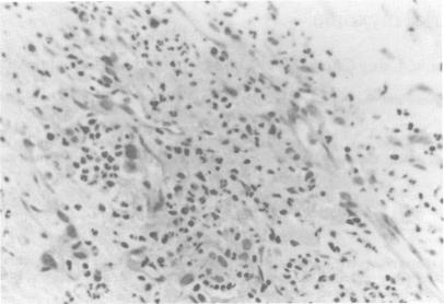 https://cdn.ncbi.nlm.nih.gov/pmc/blobs/9bd8/2429203/c6113845ec2b/postmedj00177-0065-a.jpg