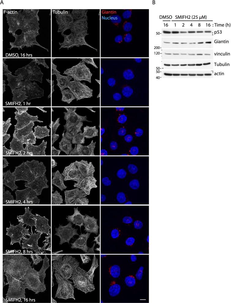 https://cdn.ncbi.nlm.nih.gov/pmc/blobs/9bd9/5386218/fd90eaa3db73/srep09802-f2.jpg