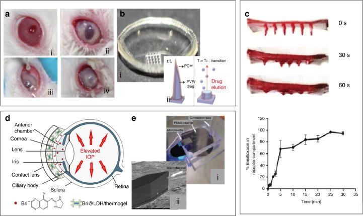 https://cdn.ncbi.nlm.nih.gov/pmc/blobs/9bd9/8433455/57b578d6d687/41378_2021_238_Fig7_HTML.jpg
