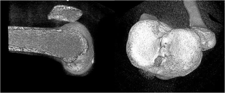 https://cdn.ncbi.nlm.nih.gov/pmc/blobs/9be2/12126020/a7319aeeb806/gr13.jpg