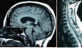 https://cdn.ncbi.nlm.nih.gov/pmc/blobs/9be2/2796052/239b7231f318/1471-2474-10-S1-S1-1.jpg