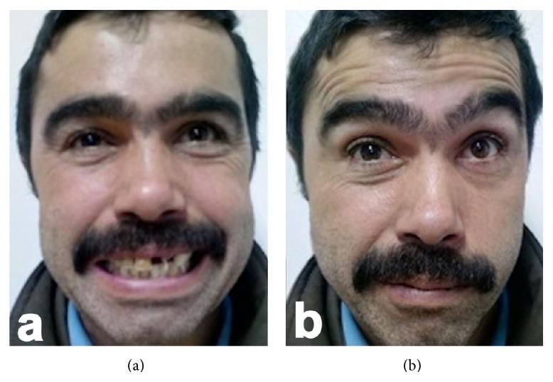 https://cdn.ncbi.nlm.nih.gov/pmc/blobs/9be5/4484562/5831ddcd532d/CRIOT2015-306950.002.jpg