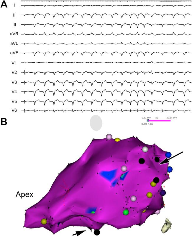 https://cdn.ncbi.nlm.nih.gov/pmc/blobs/9be7/6342609/796a90dd5450/gr2.jpg