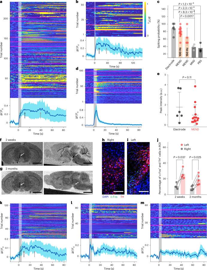 https://cdn.ncbi.nlm.nih.gov/pmc/blobs/9be8/11750723/481e44df8a32/41565_2024_1798_Fig5_HTML.jpg